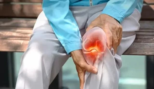 Tahun 2050 Satu Miliar Orang Akan Terkena Penyakit Osteoartritis