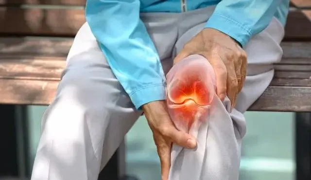 Tahun 2050 Satu Miliar Orang Akan Terkena Penyakit Osteoartritis