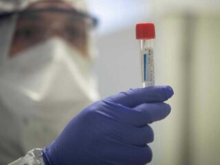 Perusahaan farmasi AS bergerak cepat, alat tes virus Corona dari Roche disetujui FDA segera dipasarkan