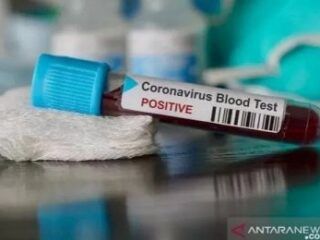 Obat corona sudah ada di Indonesia, BPOM berikan izin penggunaan darurat Avifavir dari Rusia untuk sembuhkan pasien Covid-19